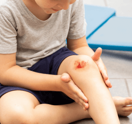 Consejos para prevenir lesiones en los pies de los niños